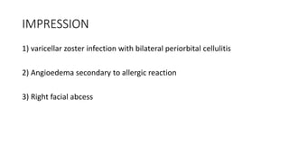 IMPRESSION
1) varicellar zoster infection with bilateral periorbital cellulitis
2) Angioedema secondary to allergic reaction
3) Right facial abcess
 