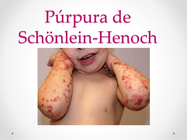 Pulmon del Granjero y Púrpura de Schönlein-Henoch