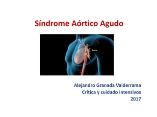 Síndrome Aórtico Agudo
Alejandro Granada Valderrama
Crítica y cuidado intensivos
2017
 