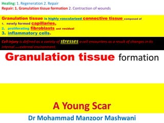 Granulation tissue formation
Dr Mohammad Manzoor Mashwani
Healing: 1. Regeneration 2. Repair
Repair: 1. Granulation tissue formation 2. Contraction of wounds
Granulation tissue is highly vascularized connective tissue composed of
1. newly formed capillaries,
2. proliferating fibroblasts and residual
3. inflammatory cells.
Cell injury is defined as a variety of stresses a cell encounters as a result of changes in its
internal and external environment.
 