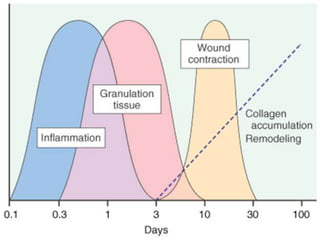 Granulation tissue formation | PPTX