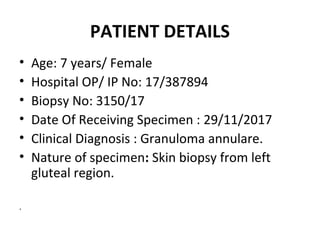 PATIENT DETAILS
• Age: 7 years/ Female
• Hospital OP/ IP No: 17/387894
• Biopsy No: 3150/17
• Date Of Receiving Specimen : 29/11/2017
• Clinical Diagnosis : Granuloma annulare.
• Nature of specimen: Skin biopsy from left
gluteal region.
.
 
