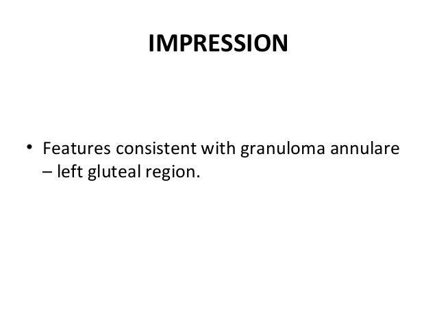 Granuloma annulare 2.0