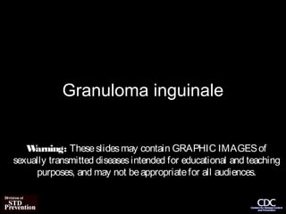 Granuloma inguinale


   W arning: These slides may contain GRAPHIC IMAGES of
sexually transmitted diseases intended for educational and teaching
     purposes, and may not be appropriate for all audiences.
 
