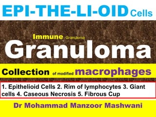 Granuloma
Dr Mohammad Manzoor Mashwani
Collection of modified macrophages
EPI-THE-LI-OIDCells
Immune Granuloma
1. Epithelioid Cells 2. Rim of lymphocytes 3. Giant
cells 4. Caseous Necrosis 5. Fibrous Cup
 
