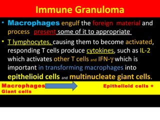 Immune Granuloma
• Macrophages engulf the foreign  material and 
process   present some of it to appropriate 
• T lymphocytes, causing them to become activated, 
responding T cells produce cytokines, such as IL-2 
which activates other T cells and IFN-γ which is 
important in transforming macrophages into 
epithelioid cells and multinucleate giant cells.
• MaMacrophages Epithelioid cells +
Giant cells
 