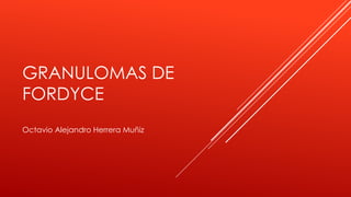 GRANULOMAS DE
FORDYCE
Octavio Alejandro Herrera Muñiz
 