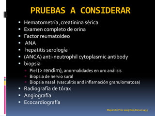 PRUEBAS A CONSIDERAR
   Hematometría ,creatinina sérica
   Examen completo de orina
   Factor reumatoideo
    ANA
    hepatitis serología
   (ANCA) anti-neutrophil cytoplasmic antibody
   biopsia
     Piel (> rendim), anormalidades en uro análisis
     Biopsia de nervio sural
     Biopsia nasal (vasculitis and inflamación granulomatosa)
 Radiografía de tórax
 Angiografía
 Ecocardiografía
                                             Mayo Clin Proc 2005 Nov;80(11):1435
 