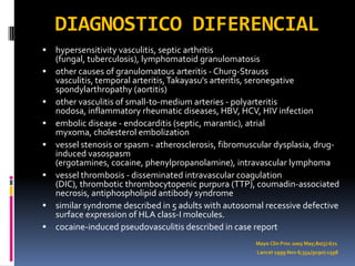 DIAGNOSTICO DIFERENCIAL
   hypersensitivity vasculitis, septic arthritis
    (fungal, tuberculosis), lymphomatoid granulomatosis
   other causes of granulomatous arteritis - Churg-Strauss
    vasculitis, temporal arteritis, Takayasu's arteritis, seronegative
    spondylarthropathy (aortitis)
   other vasculitis of small-to-medium arteries - polyarteritis
    nodosa, inflammatory rheumatic diseases, HBV, HCV, HIV infection
   embolic disease - endocarditis (septic, marantic), atrial
    myxoma, cholesterol embolization
   vessel stenosis or spasm - atherosclerosis, fibromuscular dysplasia, drug-
    induced vasospasm
    (ergotamines, cocaine, phenylpropanolamine), intravascular lymphoma
   vessel thrombosis - disseminated intravascular coagulation
    (DIC), thrombotic thrombocytopenic purpura (TTP), coumadin-associated
    necrosis, antiphospholipid antibody syndrome
   similar syndrome described in 5 adults with autosomal recessive defective
    surface expression of HLA class-I molecules.
   cocaine-induced pseudovasculitis described in case report
                                                        Mayo Clin Proc 2005 May;80(5):671
                                                        Lancet 1999 Nov 6;354(9190):1598
 