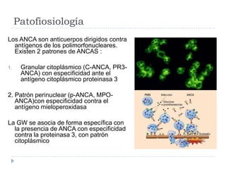 Patofiosiología
Los ANCA son anticuerpos dirigidos contra
antígenos de los polimorfonucleares.
Existen 2 patrones de ANCAS :
1. Granular citoplásmico (C-ANCA, PR3-
ANCA) con especificidad ante el
antígeno citoplásmico proteinasa 3
2. Patrón perinuclear (p-ANCA, MPO-
ANCA)con especificidad contra el
antígeno mieloperoxidasa
La GW se asocia de forma específica con
la presencia de ANCA con especificidad
contra la proteinasa 3, con patrón
citoplásmico
 