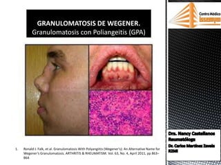 GRANULOMATOSIS DE WEGENER.
Granulomatosis con Poliangeitis (GPA)
1. Ronald J. Falk, et al. Granulomatosis With Polyangiitis (Wegener’s): An Alternative Name for
Wegener’s Granulomatosis. ARTHRITIS & RHEUMATISM. Vol. 63, No. 4, April 2011, pp 863–
864
 