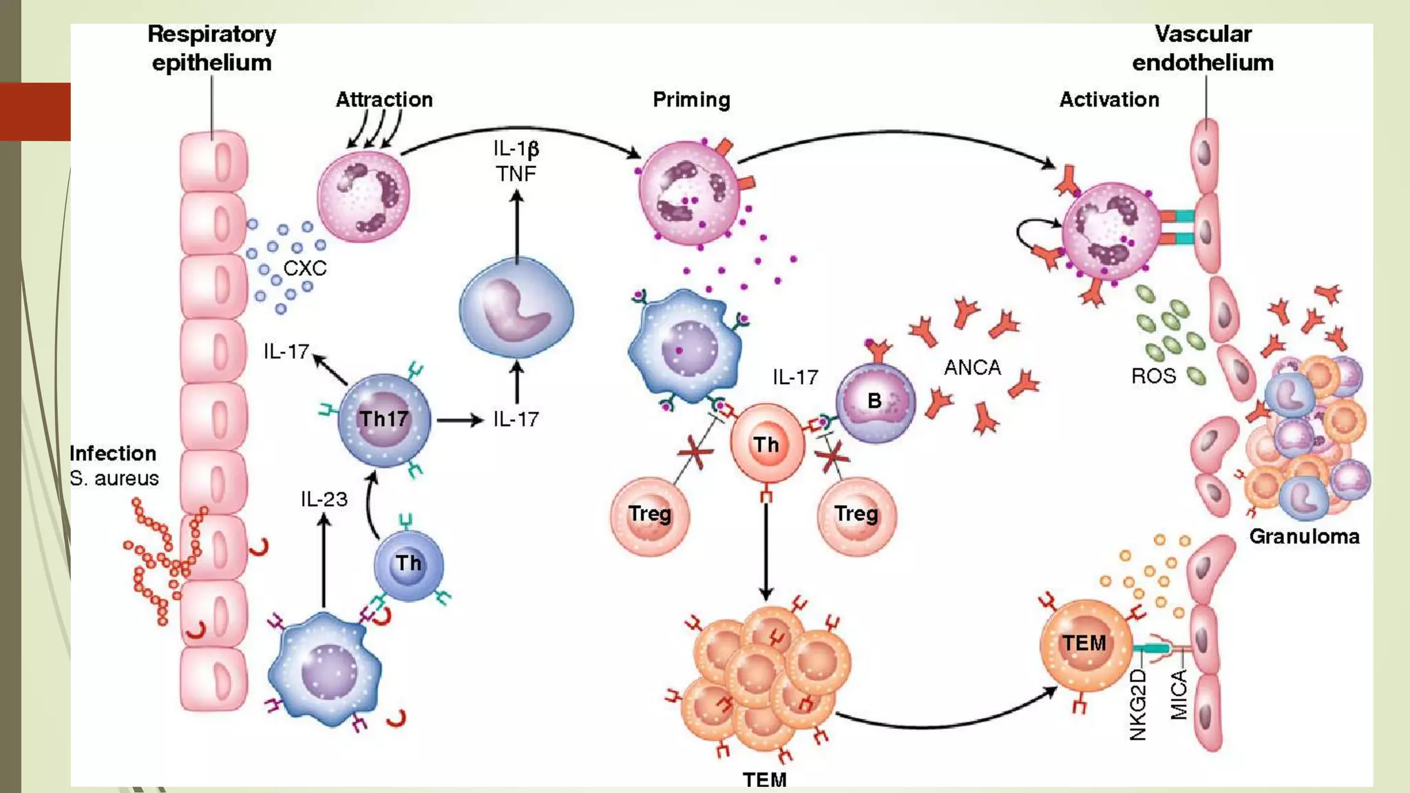 Granulomatosis polyangitis GPA | PPTX
