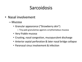Sarcoidosis
• Nasal involvement
– Mucosa
• Granular appearance (“Strawberry skin”)
– Tiny pale granulomas against a erythematous mucosa
• Very friable mucosa
• Crusting, nasal congestion, mucopurulent discharge
• Anterior septal perforation & later nasal bridge collapse
• Paranasal sinus involvement & infection
 
