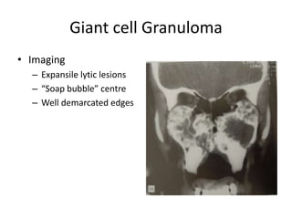 Giant cell Granuloma
• Imaging
– Expansile lytic lesions
– “Soap bubble” centre
– Well demarcated edges
 