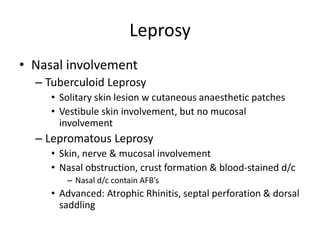 Leprosy
• Nasal involvement
– Tuberculoid Leprosy
• Solitary skin lesion w cutaneous anaesthetic patches
• Vestibule skin involvement, but no mucosal
involvement
– Lepromatous Leprosy
• Skin, nerve & mucosal involvement
• Nasal obstruction, crust formation & blood-stained d/c
– Nasal d/c contain AFB’s
• Advanced: Atrophic Rhinitis, septal perforation & dorsal
saddling
 
