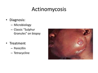 Actinomycosis
• Diagnosis:
– Microbiology
– Classic “Sulphur
Granules” on biopsy
• Treatment
– Penicillin
– Tetracycline
 