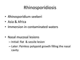 Rhinosporidiosis
• Rhinosporidium seeberi
• Asia & Africa
• Immersion in contaminated waters
• Nasal mucosal lesions
– Initial: flat & sessile lesion
– Later: Painless polypoid growth filling the nasal
cavity
 