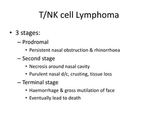 T/NK cell Lymphoma
• 3 stages:
– Prodromal
• Persistent nasal obstruction & rhinorrhoea
– Second stage
• Necrosis around nasal cavity
• Purulent nasal d/c, crusting, tissue loss
– Terminal stage
• Haemorrhage & gross mutilation of face
• Eventually lead to death
 