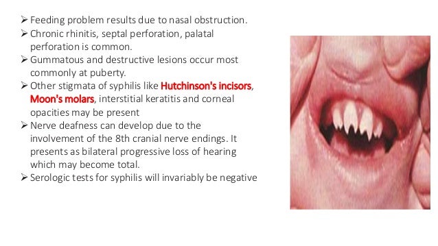Granulomatous diseases of nose
