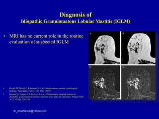 • MRI has no current role in the routine
evaluation of suspected IGLM
• Ozturk M, Mavili E, Kahriman G et al. Granulomatous mastitis: radiological
findings. Acta Radiol. 48(2), 150–1552 (2007).
• Dursun M, Yilmaz S, Yahyayev A et al. Multimodality imaging features of
idiopathic granulomatous mastitis: outcome of 12 years of experience. Radiol. Med.
2012; 117(4), 529–538
dr_omarfarouk@yahoo.com
Diagnosis of
Idiopathic Granulomatous Lobular Mastitis (IGLM)
 