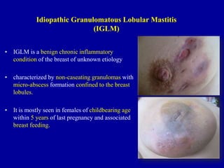 • IGLM is a benign chronic inflammatory
condition of the breast of unknown etiology
• characterized by non-caseating granulomas with
micro-abscess formation confined to the breast
lobules.
• It is mostly seen in females of childbearing age
within 5 years of last pregnancy and associated
breast feeding.
Idiopathic Granulomatous Lobular Mastitis
(IGLM)
 