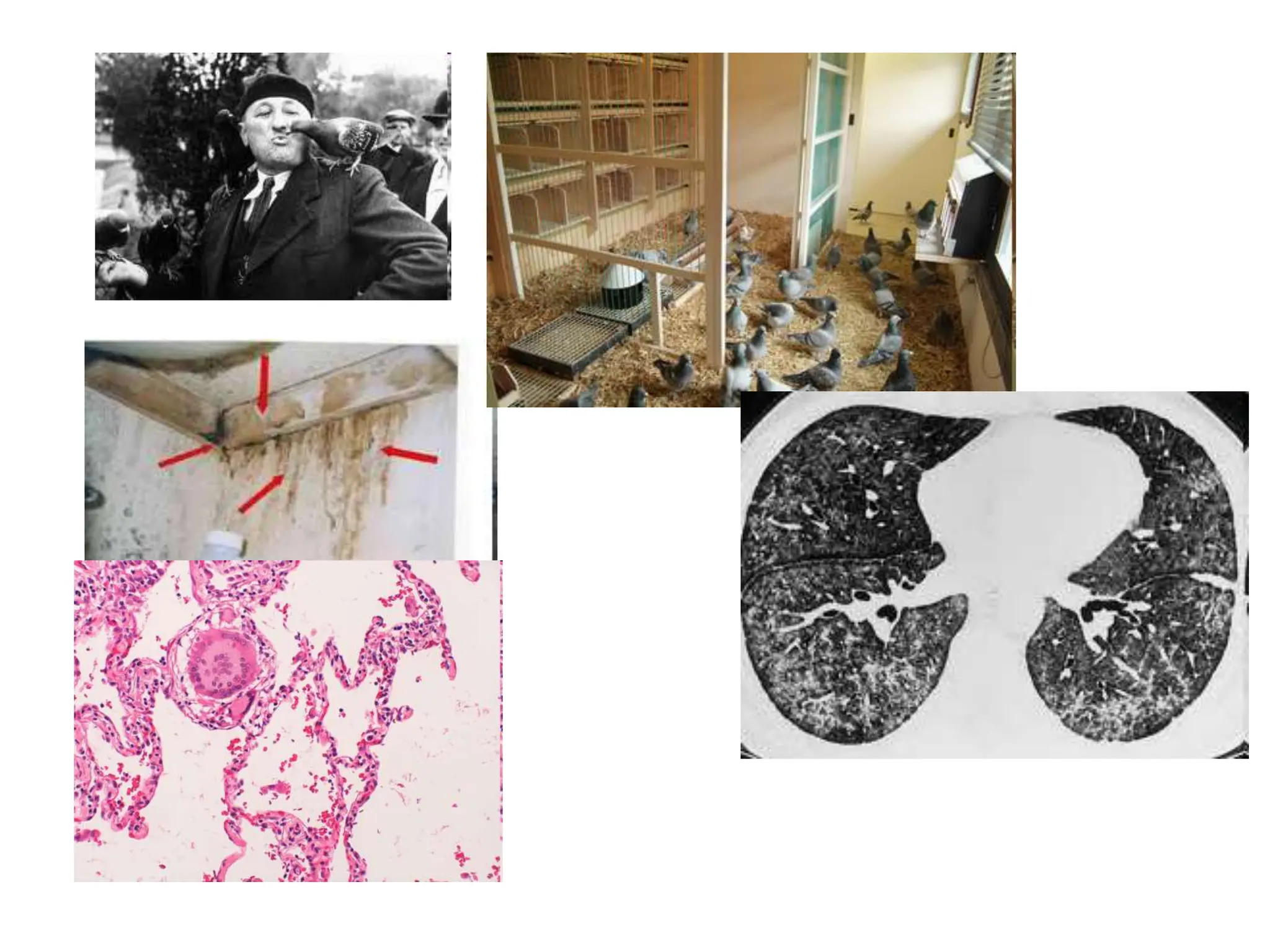 granulomatosis-presentation-on-powerpoint-ppt