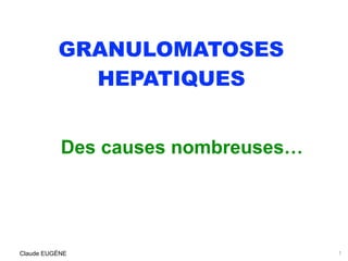 GRANULOMATOSES
HEPATIQUES
Des causes nombreuses…
1Claude EUGÈNE
 