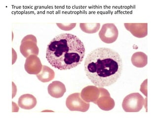 Granulocyte Defect H2o2 Granulocytes in health and disease | PPTX
