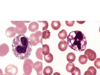 Granulocyte Defect H2o2 Granulocytes in health and disease | PPTX