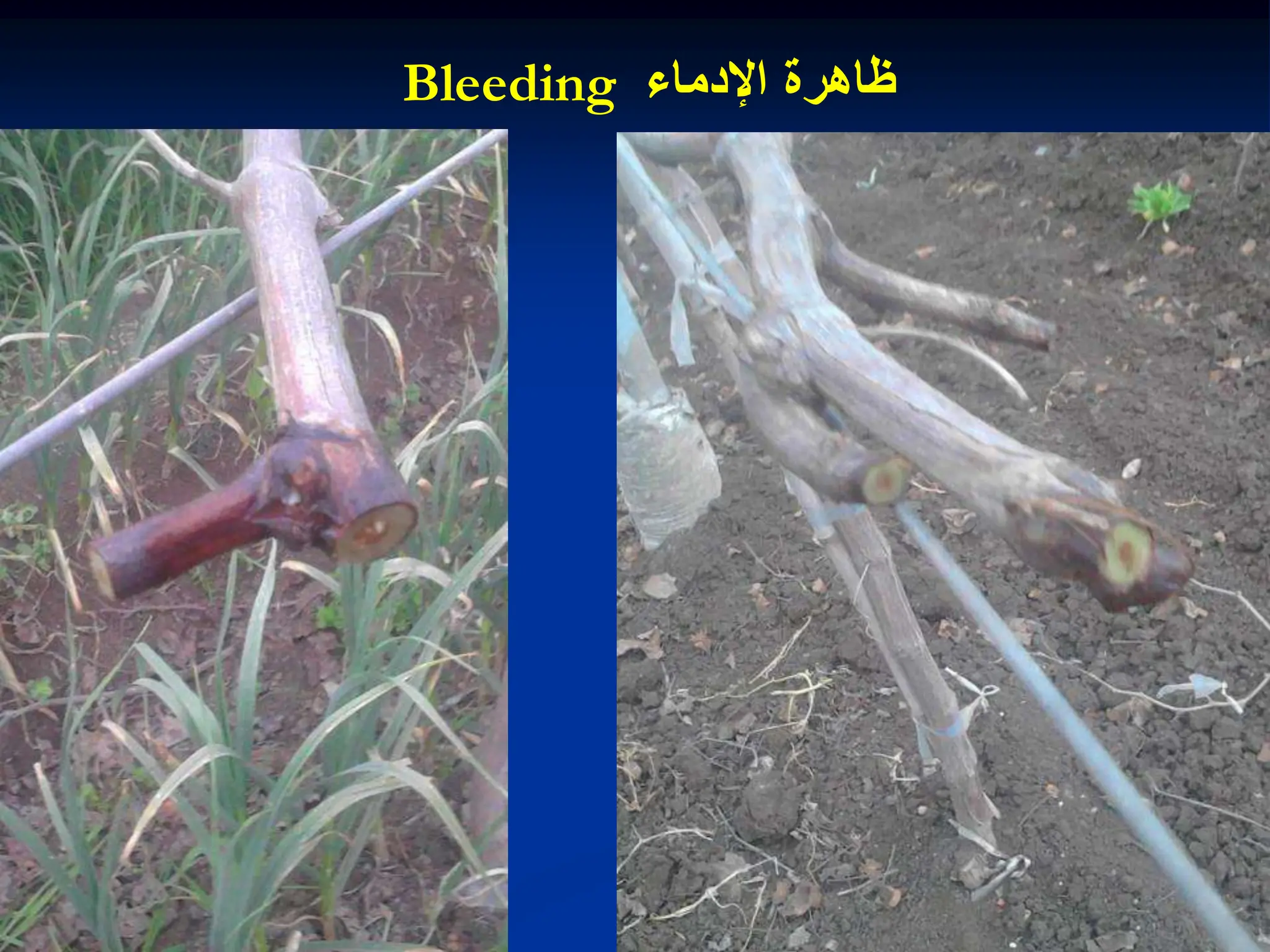 ‫اإلدماء‬ ‫ظاهرة‬
Bleeding
 