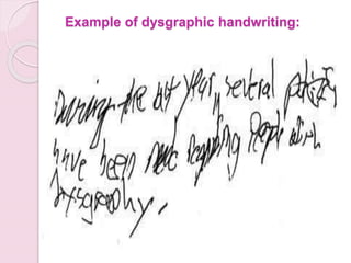 Example of dysgraphic handwriting:
 