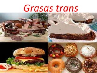 Grasas trans 
 