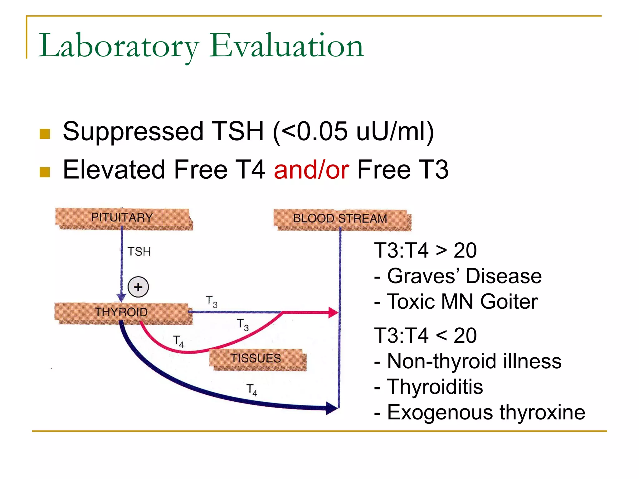 Laboratory Evaluation
n Suppressed TSH (<0.05 uU/ml)
n Elevated Free T4 and/or Free T3
T3:T4 > 20
- Graves’ Disease
- Toxic MN Goiter
T3:T4 < 20
- Non-thyroid illness
- Thyroiditis
- Exogenous thyroxine
 