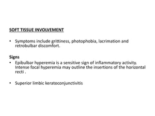 SOFT TISSUE INVOLVEMENT
• Symptoms include grittiness, photophobia, lacrimation and
retrobulbar discomfort.
Signs
• Epibulbar hyperemia is a sensitive sign of inflammatory activity.
Intense focal hyperemia may outline the insertions of the horizontal
recti .
• Superior limbic keratoconjunctivitis
 