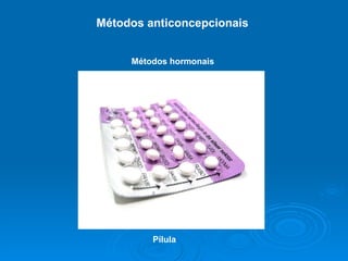 Métodos anticoncepcionais  Métodos hormonais   Pílula 