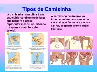 Tipos de Camisinha
A camisinha masculina é um
envoltório geralmente de látex
que recobre o órgão
reprodutor masculino, retendo
o esperma durante o ato
sexual.
A camisinha feminina é um
tubo de poliuretano com uma
extremidade fechada e a outra
aberta, acoplado a dois anéis
flexíveis.
 