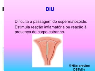 DIU
Dificulta a passagem do espermatozóide.
Estimula reação inflamatória ou reação à
presença de corpo estranho.
 