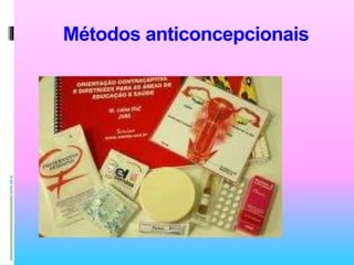 Métodos anticoncepcionais
 