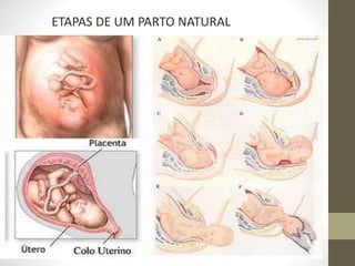 ETAPAS DE UM PARTO NATURAL
 