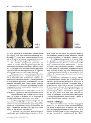 RevistaN2V80.qxd   06.05.05      11:56    Page 184




        184      Alves GF, Nogueira LSC, Varella TCN.




                                                                                                               FIGURA 5:
                                                        FIGURA 4:                                              Foliculite
                                                        Prurigo da                                             pruriginosa
                                                        gravidez.                                              da gravidez.



        gica. Seus sintomas, de acordo com achados de litera-        do-se avaliar os anticorpos anticoagulante lúpico e
        tura, podem variar na gestação entre melhora e piora         anticardiolipina nessas pacientes. Manifesta-se clinica-
        do quadro.8,27 A correlação com as variações hormo-          mente por tromboses, perdas fetais e plaquetopenia.
        nais evidencia-se na medida em que também se des-                   O pênfigo pode manifestar-se ou piorar duran-
        creve piora do quadro em períodos menstruais.                te a gestação. As exacerbações ocorrem no primeiro
               Em estudos prospectivos realizados em                 ou segundo trimestres, havendo aumento na morbi-
        Londres, o eczema atópico respondeu por 36% das              dade e mortalidade fetais. Clinicamente, a doença
        consultas dermatológicas em gestantes. Dessas, a maio-       não difere de sua apresentação habitual. O diagnósti-
        ria (52%) revelou piora do quadro durante a gravidez.        co diferencial com o penfigóide gestacional é impor-
        Há relatos, aliás, de aparecimento inicial de dermatite      tante, podendo ser feito por particularidades clínicas
        atópica na gravidez em mulheres predispostas.28              e pela imunofluorescência direta. A terapia com corti-
               Muitas dermatoses apresentam prurido como             cóides é efetiva na gestação, devendo-se evitar as dro-
        manifestação clínica, mas é na dermatite atópica que         gas citotóxicas.8
        ele se apresenta como manifestação cardinal. Sua                    É controversa a influência da gestação sobre o
        diferenciação de moléstias como o eritema polimórfi-         melanoma maligno, uma vez que a conseqüência das
        co da gravidez é importante, pois possibilita orienta-       alterações hormonais em sua gênese ainda não se
        ções mais adequadas assim como o devido tratamen-            encontra plenamente definida. De maneira geral, o
        to. Indiretamente, a dermatite atópica causa prejuízo        prognóstico do melanoma na gestante vai depender
        para a gestante, uma vez que altera sua dieta, sono e        diretamente da espessura do tumor, assim como nos
        bem estar emocional.                                         pacientes em geral. Já foram descritos relatos de
               No tratamento deve-se resguardar o uso de cor-        metástases para o feto e recomenda-se evitar a gravi-
        ticosteróides tópicos mais potentes para evitar estrias.     dez por pelo menos dois anos após a exérese do
               Outras manifestações alérgicas que se encon-          tumor.8 O tratamento dessa enfermidade na gravidez
        tram exacerbadas na gestante são as do complexo              é obviamente dificultado, pois devem ser evitadas as
        urticária/angioedema, e devem ser observadas.27              drogas citotóxicas em pacientes gestantes.
               O lúpus eritematoso sistêmico ainda tem seu
        comportamento debatido na gravidez. Para alguns              DROGAS E GESTAÇÃO
        autores, sua recrudescência é mais grave na gestante,              No desenvolvimento de uma nova droga, geral-
        com maior acometimento cutâneo (vasculites) e arti-          mente não são realizados testes em mulheres grávi-
        cular. O tratamento sistêmico com corticóides e anti-        das. Como conseqüência, a segurança no uso da
        maláricos não deve ser interrompido.8,11                     maioria dos medicamentos em gestantes não foi devi-
               A síndrome do anticorpo antifosfolipídio é            damente avaliada. Em geral, as recomendações suge-
        manifestação grave ligada ao lúpus eritematoso, deven-       rem que o uso pode ser realizado desde que o bene-

        An Bras Dermatol. 2005;80(2):179-86.
 