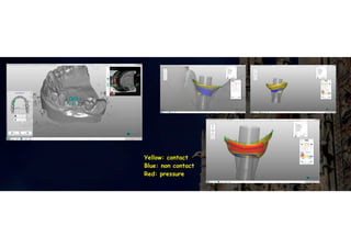 Yellow: contact
Blue: non contact
Red: pressure