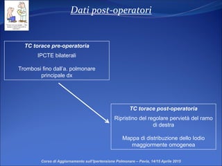 Dati post-operatori
Corso di Aggiornamento sull’Ipertensione Polmonare – Pavia, 14/15 Aprile 2015
TC torace pre-operatoria
IPCTE bilaterali
Trombosi fino dall’a. polmonare
principale dx
TC torace post-operatoria
Ripristino del regolare pervietà del ramo
di destra
Mappa di distribuzione dello Iodio
maggiormente omogenea
 