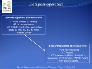 Dati post-operatori
Corso di Aggiornamento sull’Ipertensione Polmonare – Pavia, 14/15 Aprile 2015
Ecocardiogramma pre-operatorio
• PAPs stimata 90 mmHg
• IT moderato-severa
• VD dilatato, ipertrofico, ipocinetico
(DTD 38 mm, TAPSE 13 mm)
• Pletora cavale
Ecocardiogramma post-operatorio
• PAPs non valutabile
• IT esigua
• VD lievemente dilatato, ipertrofico,
ipocinetico (DTD 32 mm, TAPSE 7 mm)
• Non pletora cavale
 