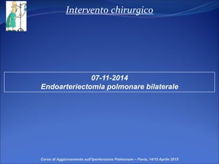 Intervento chirurgico
07-11-2014
Endoarteriectomia polmonare bilaterale
Corso di Aggiornamento sull’Ipertensione Polmonare – Pavia, 14/15 Aprile 2015
 