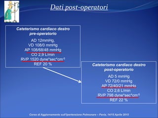 Dati post-operatori
Cateterismo cardiaco destro
post-operatorio
AD 5 mmHg
VD 72/0 mmHg
AP 72/40/21 mmHg
CO 2,6 L/min
RVP 798 dyne*sec*cm-5
REF 22 %
Corso di Aggiornamento sull’Ipertensione Polmonare – Pavia, 14/15 Aprile 2015
Cateterismo cardiaco destro
pre-operatorio
AD 12mmHg,
VD 108/0 mmHg
AP 108/68/48 mmHg
CO 2,9 L/min
RVP 1520 dyne*sec*cm-5
REF 20 %
 