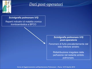 Dati post-operatori
Corso di Aggiornamento sull’Ipertensione Polmonare – Pavia, 14/15 Aprile 2015
Scintigrafia polmonare V/Q
post-operatoria
Fenomeni di furto prevalentemente dal
lobo inferiore sinistro
Ridistribuzione irregolare della
perfusione nel restante ambito
polmonare.
Scintigrafia polmonare V/Q
Reperti indicativi di malattia cronica
tromboembolica e BPCO
 