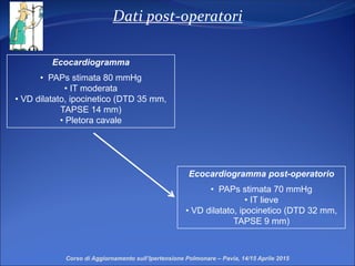 Dati post-operatori
Corso di Aggiornamento sull’Ipertensione Polmonare – Pavia, 14/15 Aprile 2015
Ecocardiogramma
• PAPs stimata 80 mmHg
• IT moderata
• VD dilatato, ipocinetico (DTD 35 mm,
TAPSE 14 mm)
• Pletora cavale
Ecocardiogramma post-operatorio
• PAPs stimata 70 mmHg
• IT lieve
• VD dilatato, ipocinetico (DTD 32 mm,
TAPSE 9 mm)
 