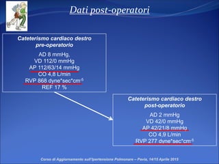 Dati post-operatori
Cateterismo cardiaco destro
post-operatorio
AD 2 mmHg
VD 42/0 mmHg
AP 42/21/8 mmHg
CO 4,9 L/min
RVP 277 dyne*sec*cm-5
Corso di Aggiornamento sull’Ipertensione Polmonare – Pavia, 14/15 Aprile 2015
Cateterismo cardiaco destro
pre-operatorio
AD 8 mmHg,
VD 112/0 mmHg
AP 112/63/14 mmHg
CO 4,8 L/min
RVP 868 dyne*sec*cm-5
REF 17 %
 