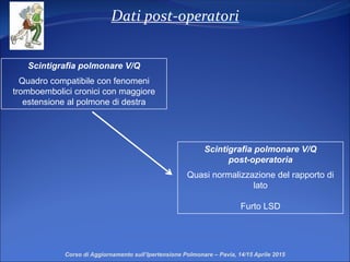Dati post-operatori
Corso di Aggiornamento sull’Ipertensione Polmonare – Pavia, 14/15 Aprile 2015
Scintigrafia polmonare V/Q
post-operatoria
Quasi normalizzazione del rapporto di
lato
Furto LSD
Scintigrafia polmonare V/Q
Quadro compatibile con fenomeni
tromboembolici cronici con maggiore
estensione al polmone di destra
 