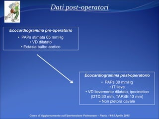 Dati post-operatori
Corso di Aggiornamento sull’Ipertensione Polmonare – Pavia, 14/15 Aprile 2015
Ecocardiogramma post-operatorio
• PAPs 30 mmHg
• IT lieve
• VD lievemente dilatato, ipocinetico
(DTD 30 mm, TAPSE 13 mm)
• Non pletora cavale
Ecocardiogramma pre-operatorio
• PAPs stimata 65 mmHg
• VD dilatato
• Ectasia bulbo aortico
 